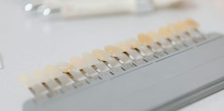Facettes dentaires en Espagne : un prix réduit sans compromis sur la qualité